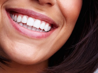 Close up of woman smiling with flawless white teeth