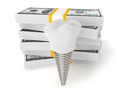 Dental implant by a pile of money