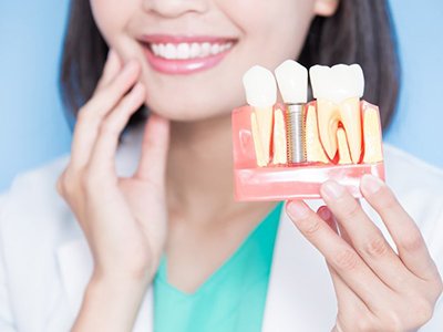 Woman smiling while holding up a dental implant model