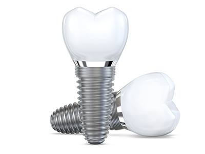 Two dental implants and crowns against white background