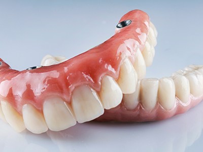 Removable implant dentures pictured against neutral background