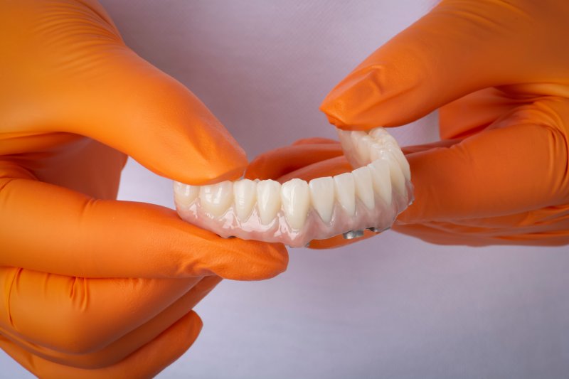 Dentist holding an implant denture